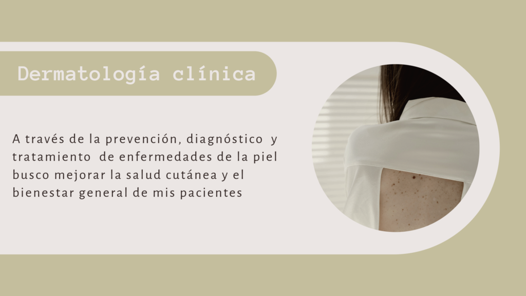 tratamiento acné - rosácea - control de lunares en Devoto y Recoleta
